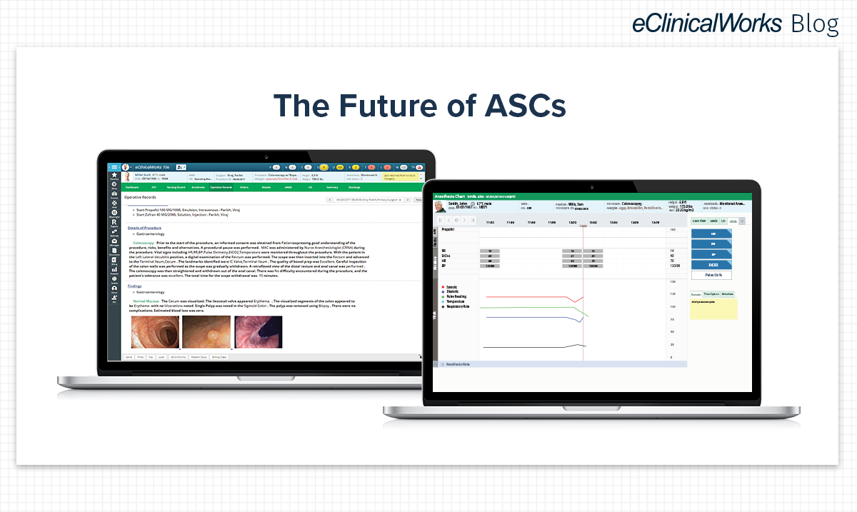 3 Ways to Prepare for the Future of ASCs